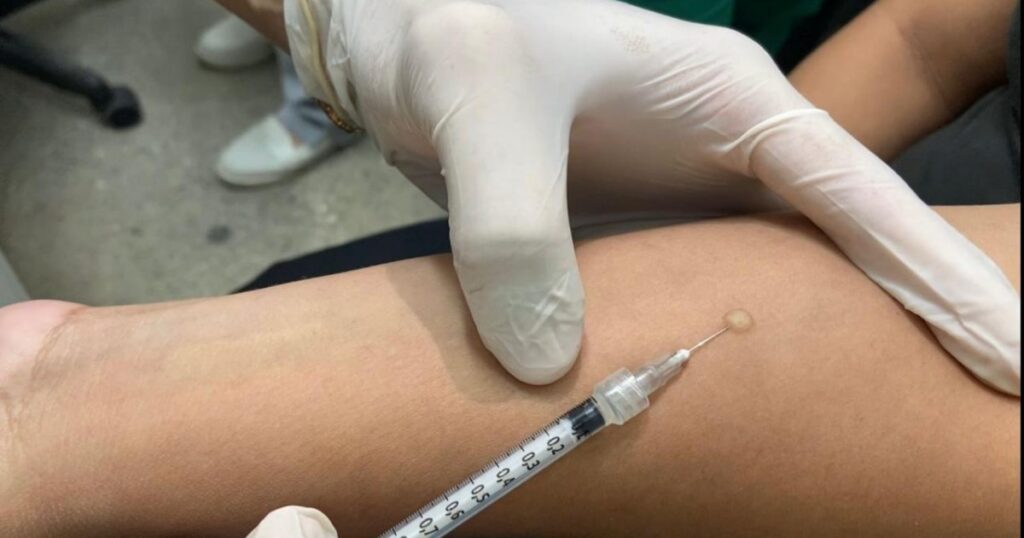 Três unidades de Manaus passam a oferecer teste para infecção por tuberculose