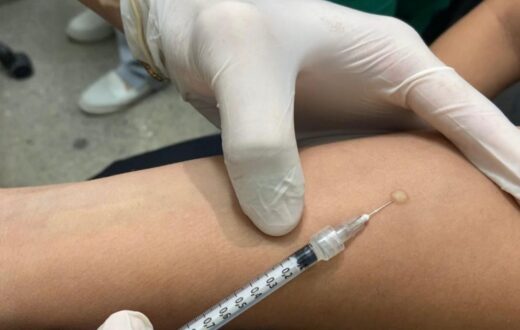 Três unidades de Manaus passam a oferecer teste para infecção por tuberculose